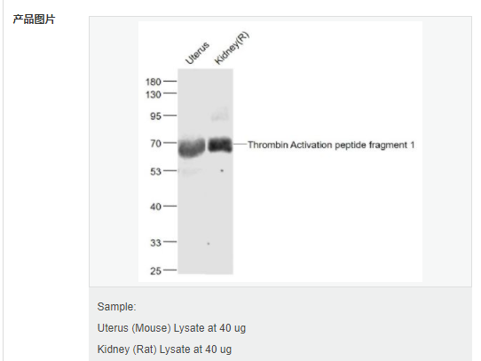 60593f7fca66b.png image.png
