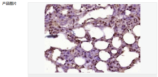 60640e39646e7.png image.png