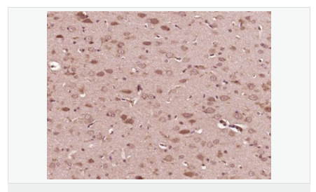 606534a718fc6.png image.png