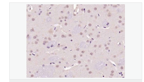 60764683cd406.png image.png