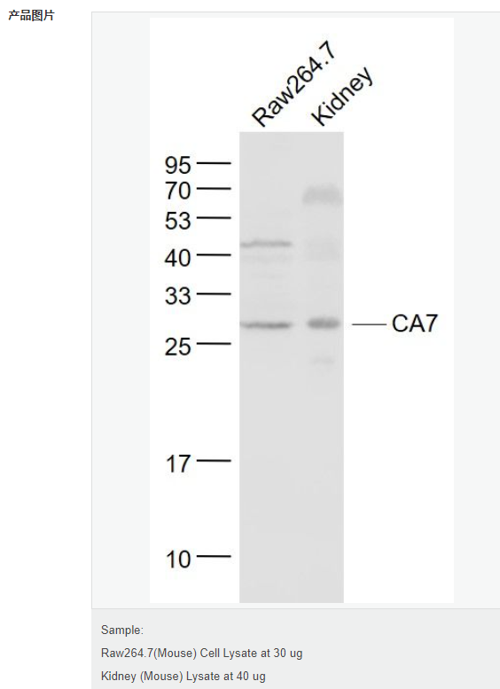 6076949625fba.png image.png